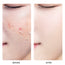 SKINEVER 3% Niacinamide Exfoliating Whitening Gel