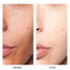 SKINEVER Salicylic Refreshing Scrub Cleanser