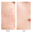 SKINEVER Centella Skin Soothing Masque
